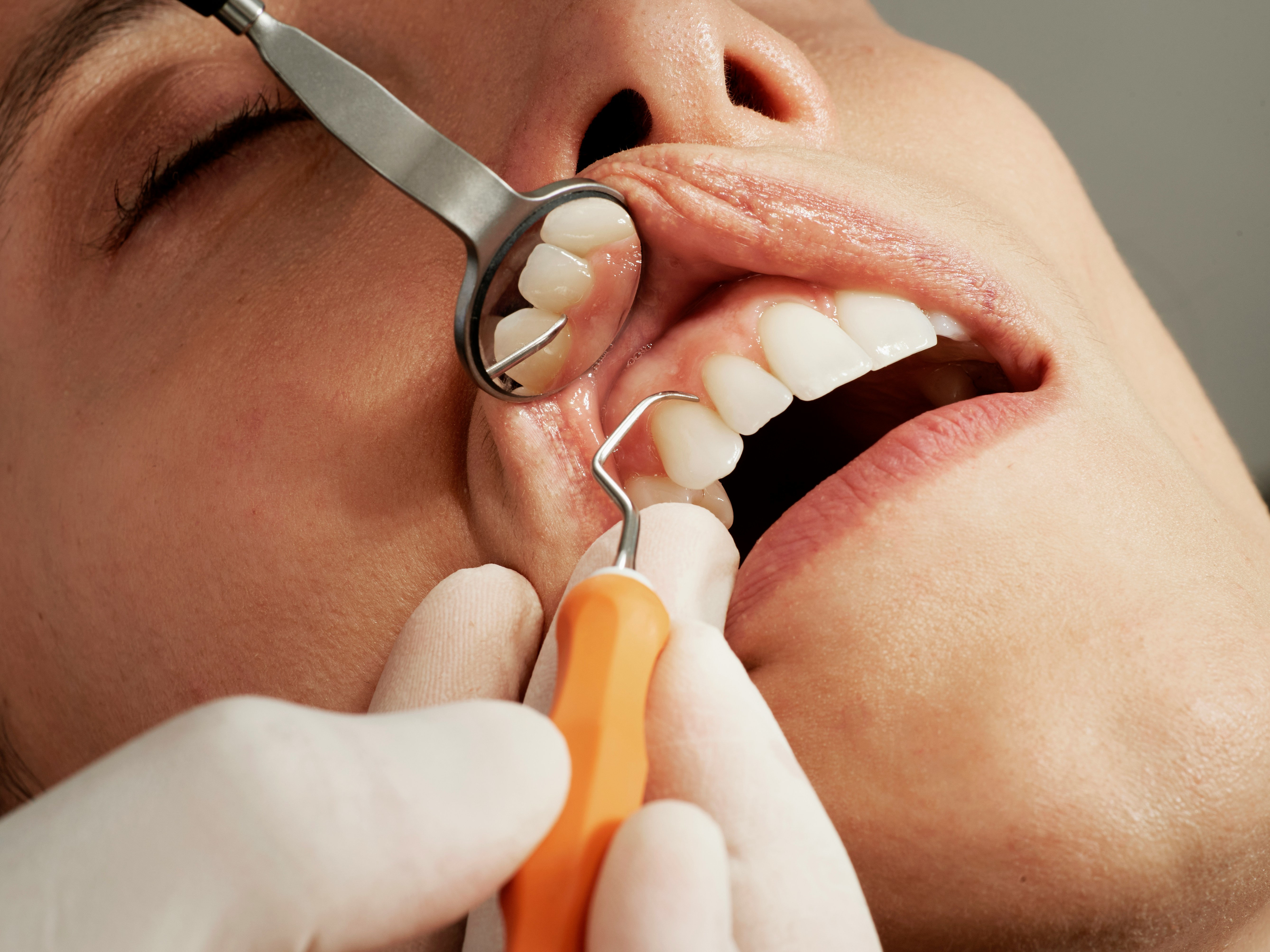 GoDental nurse and elderly patient consultation for mobile dental visit in Dublin, Ireland